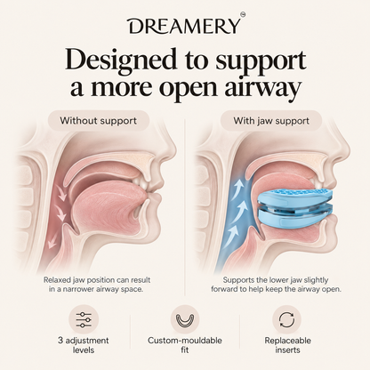 Dreamery AirFit Adjustable Anti-Snore Device