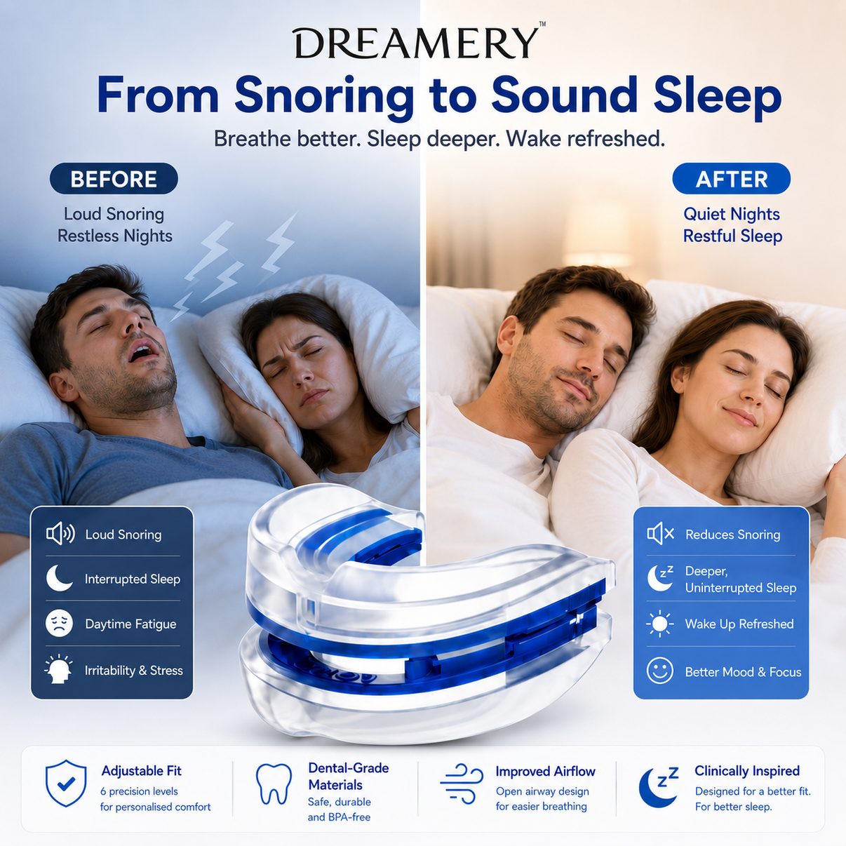 Dreamery AirFit Adjustable Anti-Snore Device