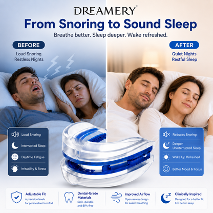 Dreamery AirFit Adjustable Anti-Snore Device