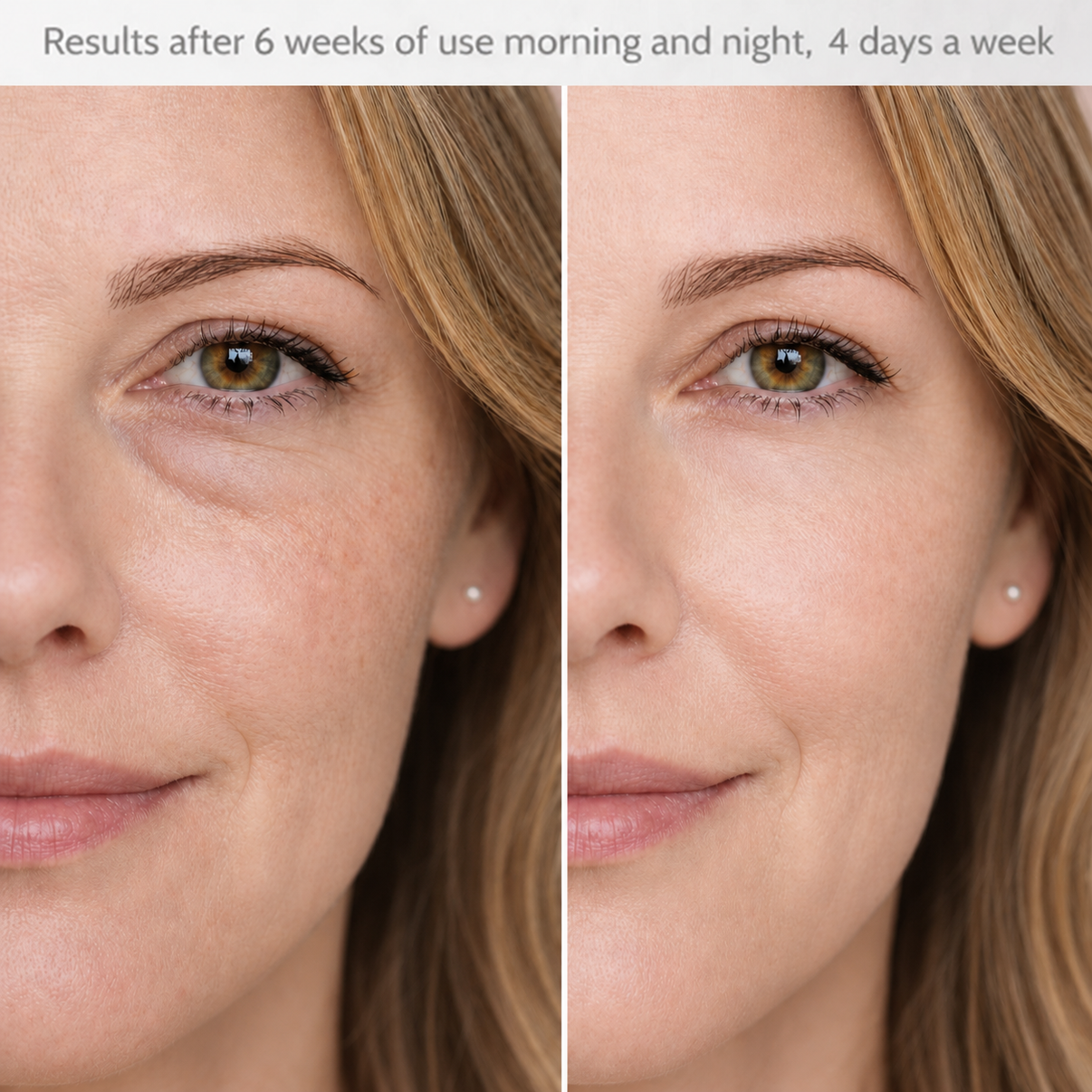 Under Eye Red Light + EMS Device | Dreamery