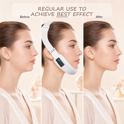 V-Face EMS Jawline Device | Dreamery